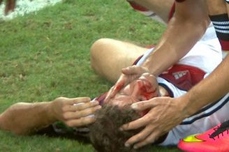 视频-穆勒读秒舍命头槌 头撞头当场血流满面